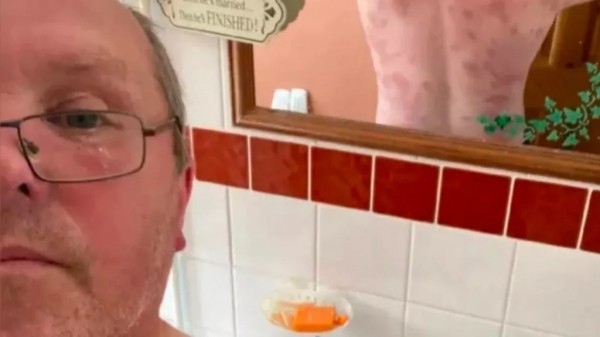 Мужчина выжил после 240 укусов ос